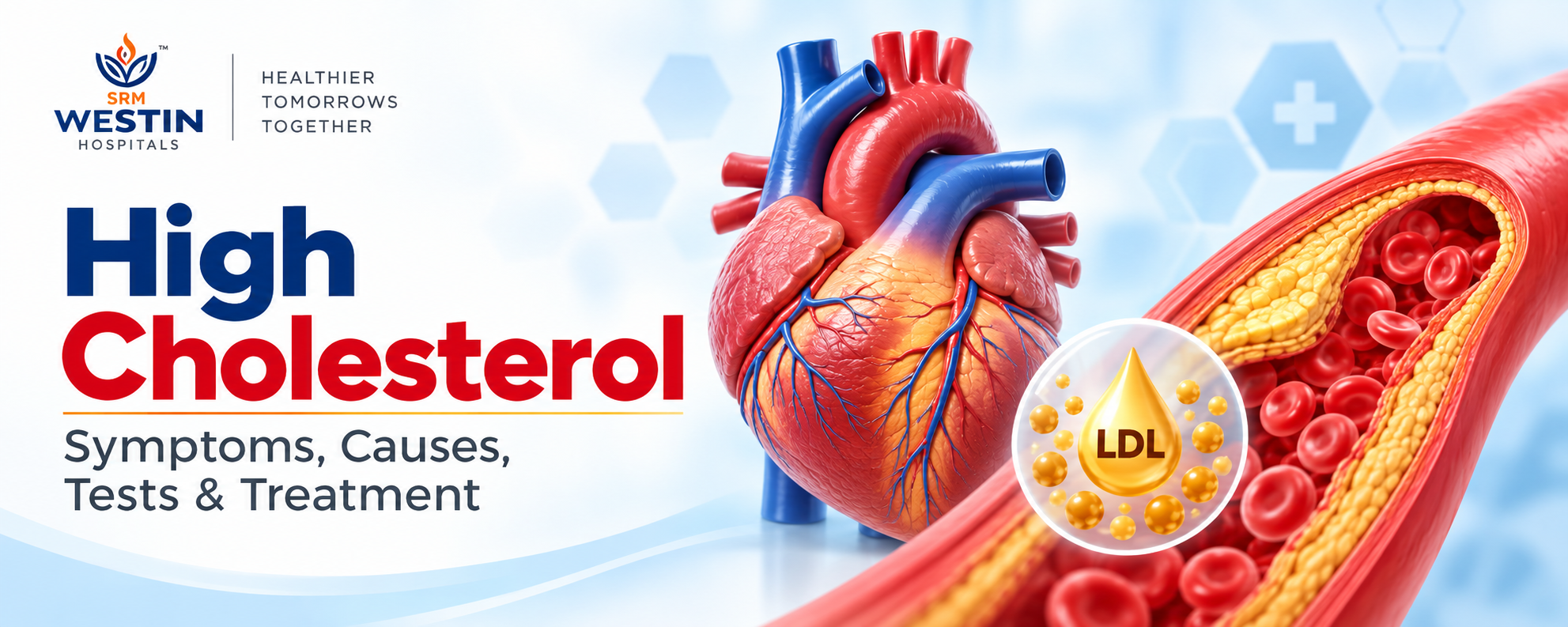 High cholesterol symptoms causes tests and treatment at Westin Hospitals